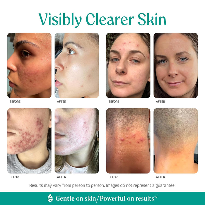 Level 1 - 10% Mandelic Acid Exfoliating Serum